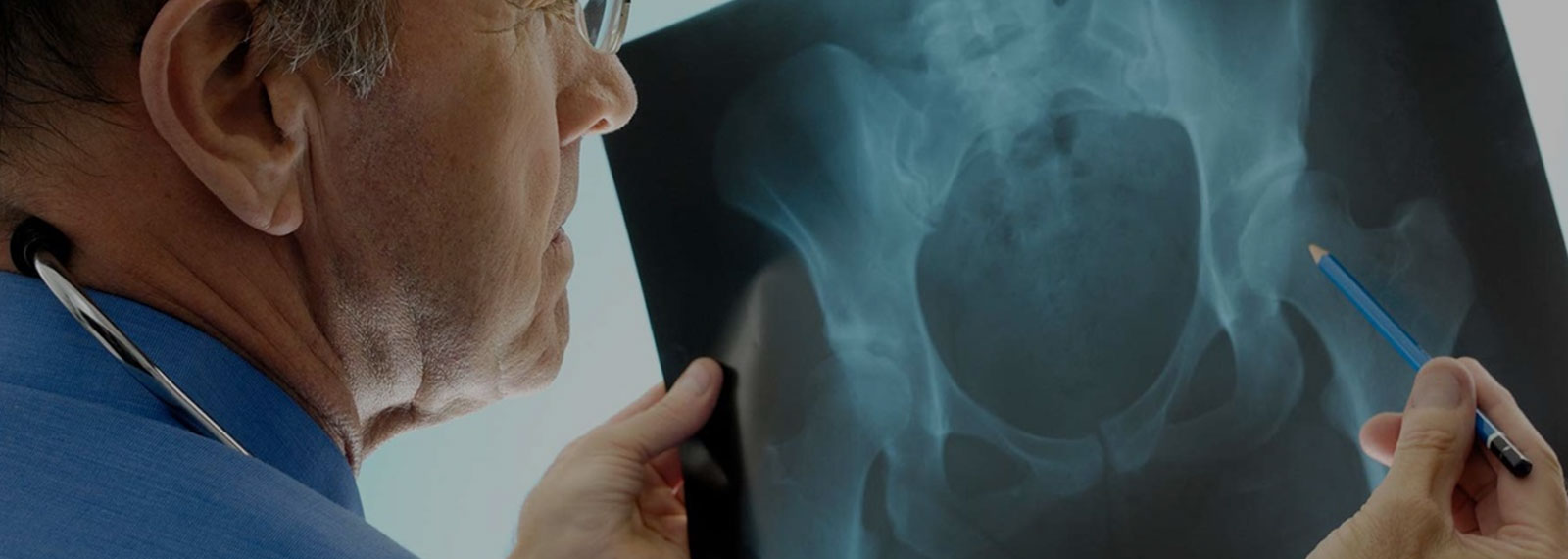 Osteoporosis Screening & Tscore, Bone Density Test